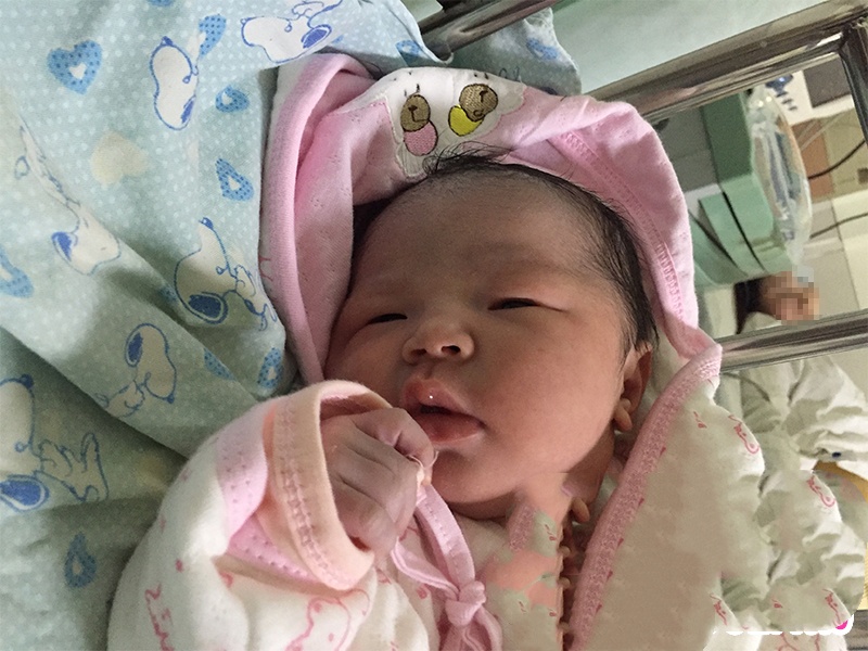 试管婴儿技术帮助巧克力囊肿剥除术患者成功产子