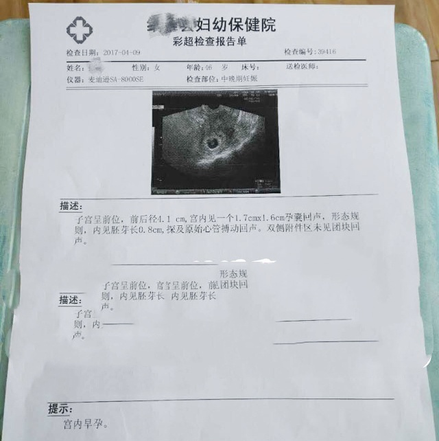 基因检测囊胚移植让孔女士成功妊娠